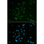 Anti-Chk2 Antibody from Bioworld Technology (BS6791) - Antibodies.com