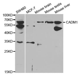 Anti-CADM1 Antibody from Bioworld Technology (BS6792) - Antibodies.com