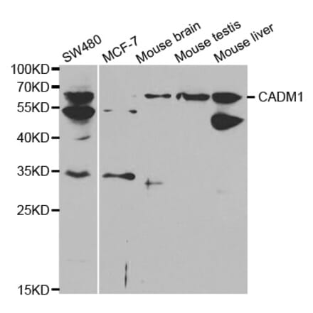 Anti-CADM1 Antibody from Bioworld Technology (BS6792) - Antibodies.com