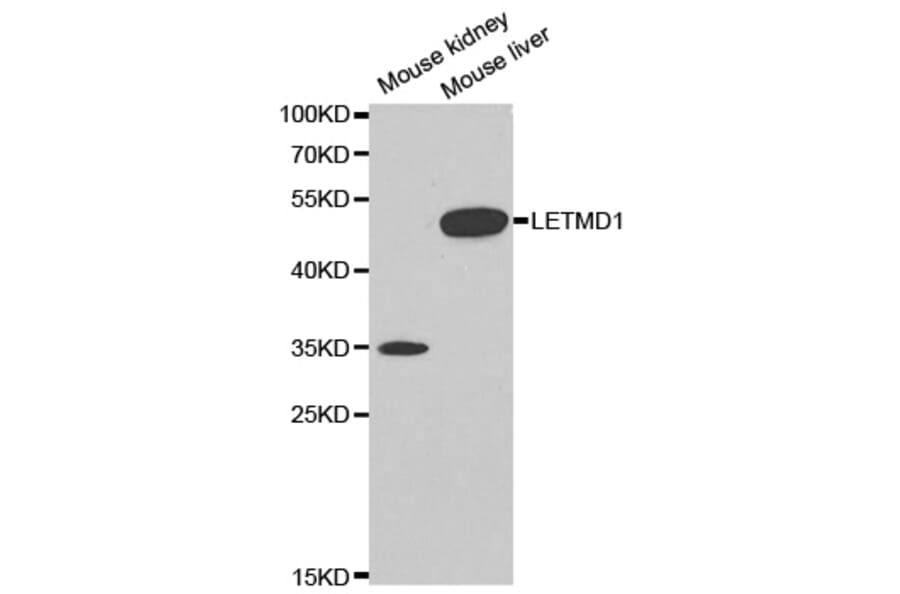 Anti-LETMD1 Antibody from Bioworld Technology (BS6793) - Antibodies.com