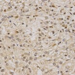 Anti-LETMD1 Antibody from Bioworld Technology (BS6793) - Antibodies.com