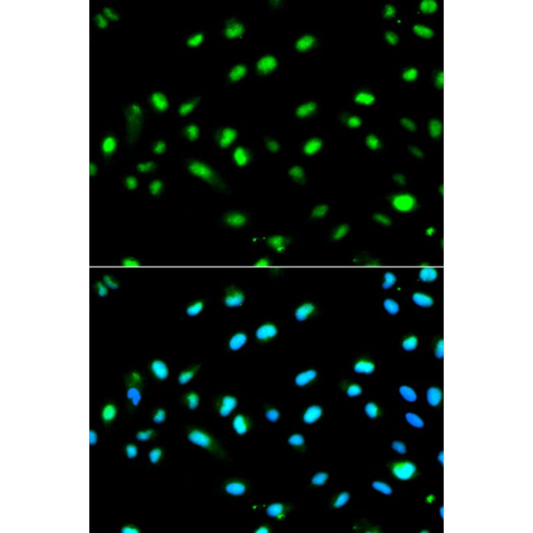 Anti-LETMD1 Antibody from Bioworld Technology (BS6793) - Antibodies.com