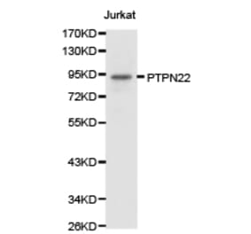 Anti-PTPN22 Antibody from Bioworld Technology (BS6794) - Antibodies.com