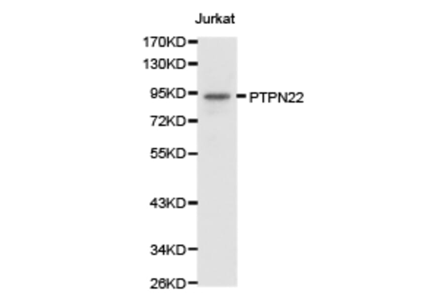 Anti-PTPN22 Antibody from Bioworld Technology (BS6794) - Antibodies.com