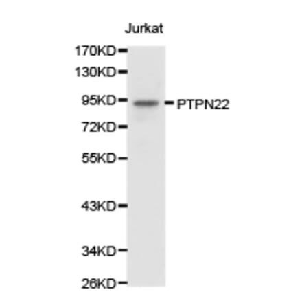 Anti-PTPN22 Antibody from Bioworld Technology (BS6794) - Antibodies.com