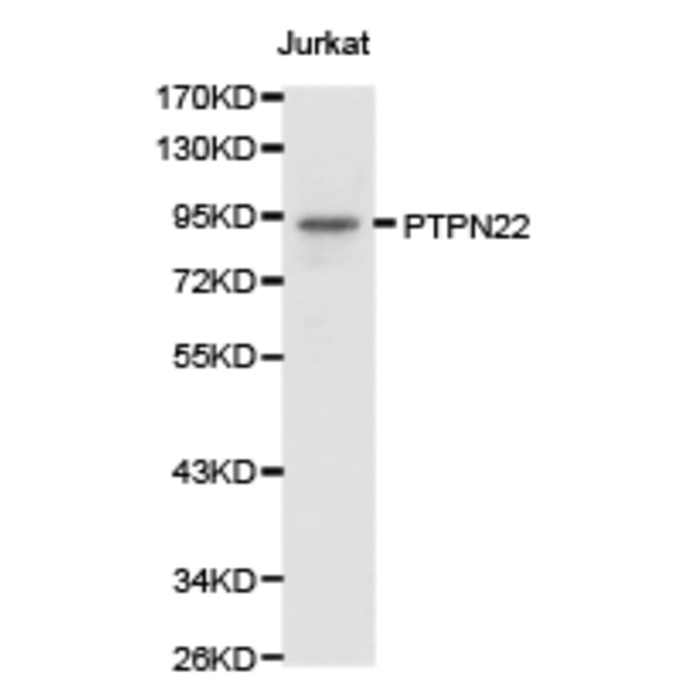 Anti-PTPN22 Antibody from Bioworld Technology (BS6794) - Antibodies.com