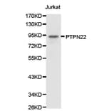 Anti-PTPN22 Antibody from Bioworld Technology (BS6794) - Antibodies.com
