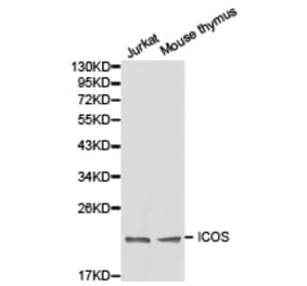 Anti-ICOS Antibody from Bioworld Technology (BS6795) - Antibodies.com