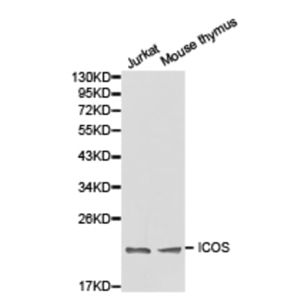 Anti-ICOS Antibody from Bioworld Technology (BS6795) - Antibodies.com