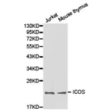 Anti-ICOS Antibody from Bioworld Technology (BS6795) - Antibodies.com