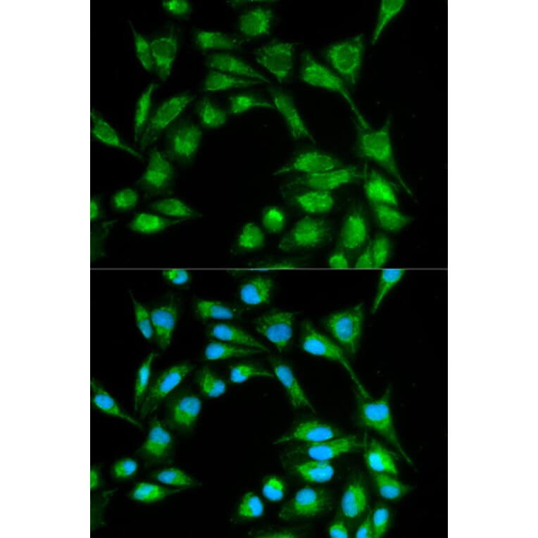 Anti-ICOS Antibody from Bioworld Technology (BS6795) - Antibodies.com