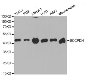 Anti-SCCPDH Antibody from Bioworld Technology (BS6798) - Antibodies.com