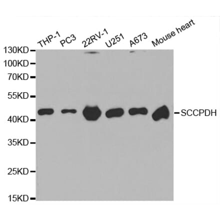 Anti-SCCPDH Antibody from Bioworld Technology (BS6798) - Antibodies.com