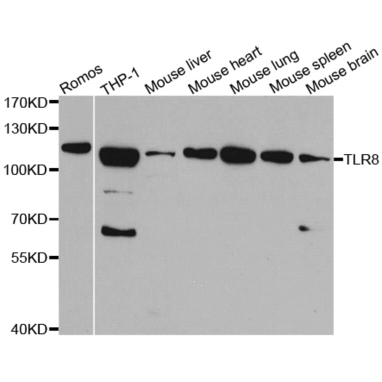 Anti-TLR8 Antibody from Bioworld Technology (BS6799) - Antibodies.com