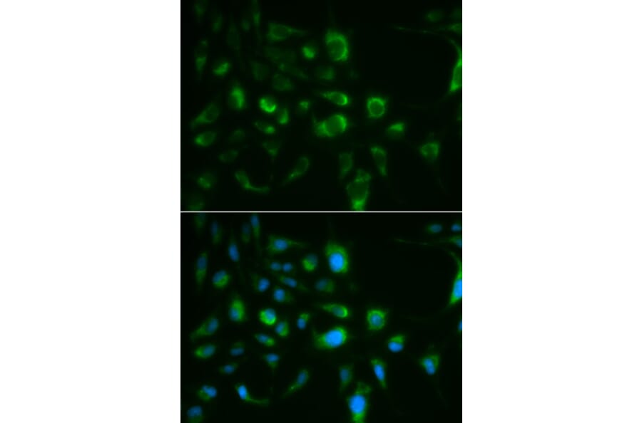 Anti-TLR8 Antibody from Bioworld Technology (BS6799) - Antibodies.com