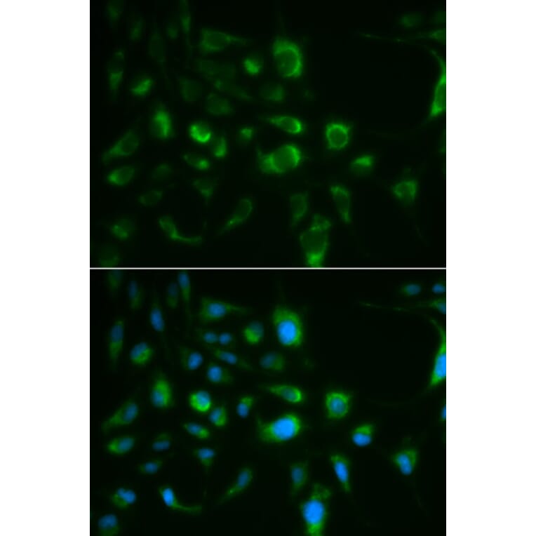 Anti-TLR8 Antibody from Bioworld Technology (BS6799) - Antibodies.com