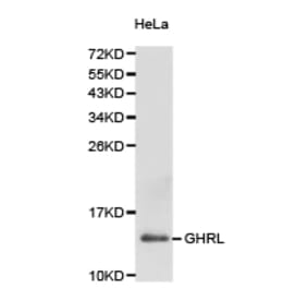 Anti-Ghrelin Antibody from Bioworld Technology (BS6800) - Antibodies.com