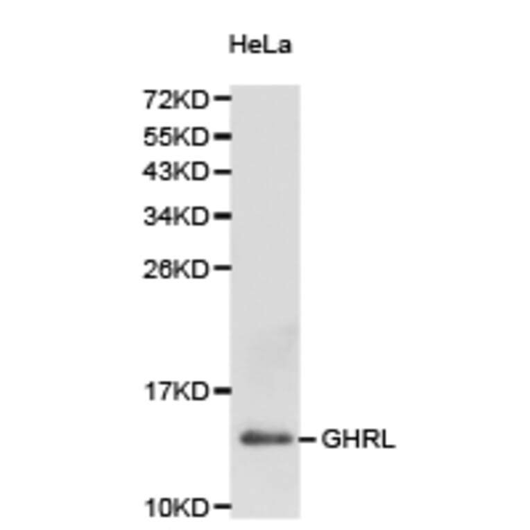 Anti-Ghrelin Antibody from Bioworld Technology (BS6800) - Antibodies.com