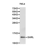 Anti-Ghrelin Antibody from Bioworld Technology (BS6800) - Antibodies.com