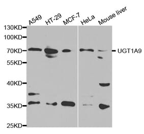 Anti-UGT1A9 Antibody from Bioworld Technology (BS6801) - Antibodies.com