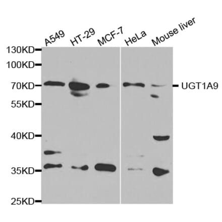 Anti-UGT1A9 Antibody from Bioworld Technology (BS6801) - Antibodies.com