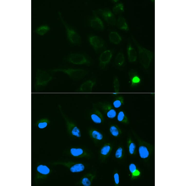 Anti-UGT1A9 Antibody from Bioworld Technology (BS6801) - Antibodies.com