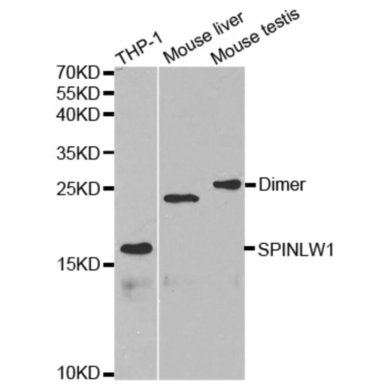 Anti-SPINLW1 Antibody from Bioworld Technology (BS6802) - Antibodies.com