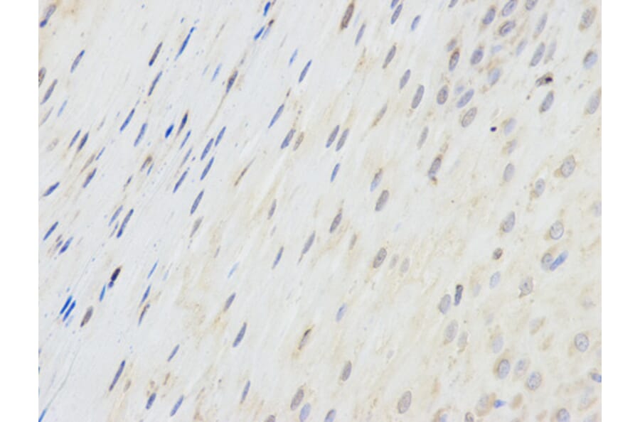 Anti-SPINLW1 Antibody from Bioworld Technology (BS6802) - Antibodies.com