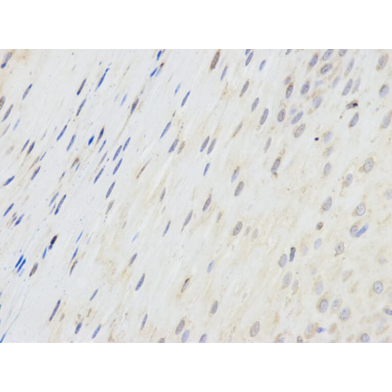 Anti-SPINLW1 Antibody from Bioworld Technology (BS6802) - Antibodies.com