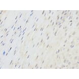 Anti-SPINLW1 Antibody from Bioworld Technology (BS6802) - Antibodies.com