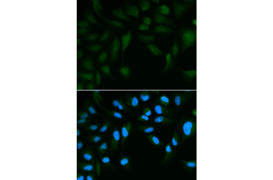 Anti-SPINLW1 Antibody from Bioworld Technology (BS6802) - Antibodies.com