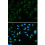 Anti-SPINLW1 Antibody from Bioworld Technology (BS6802) - Antibodies.com