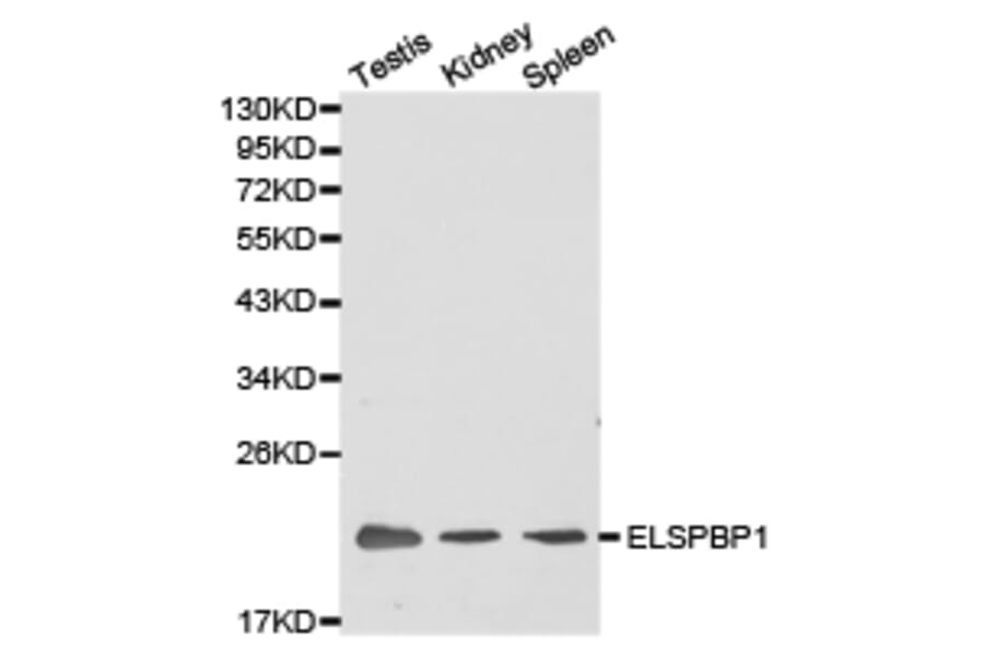 Anti-ELSPBP1 Antibody from Bioworld Technology (BS6805) - Antibodies.com