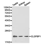 Anti-ELSPBP1 Antibody from Bioworld Technology (BS6805) - Antibodies.com