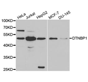 Anti-DTNBP1 Antibody from Bioworld Technology (BS6806) - Antibodies.com