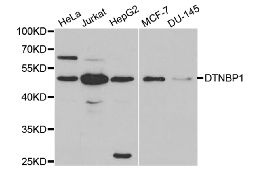 Anti-DTNBP1 Antibody from Bioworld Technology (BS6806) - Antibodies.com