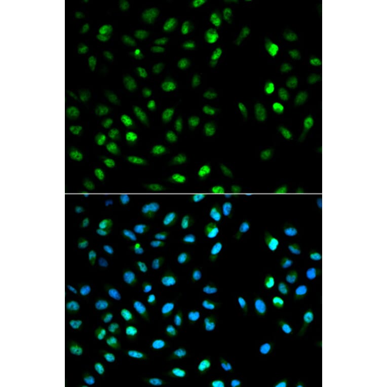 Anti-DTNBP1 Antibody from Bioworld Technology (BS6806) - Antibodies.com