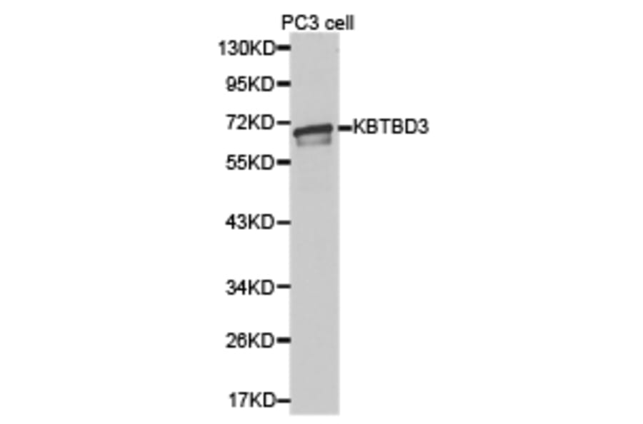 Anti-KBTBD3 Antibody from Bioworld Technology (BS6807) - Antibodies.com