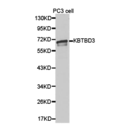 Anti-KBTBD3 Antibody from Bioworld Technology (BS6807) - Antibodies.com