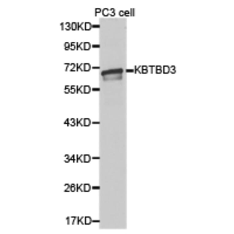 Anti-KBTBD3 Antibody from Bioworld Technology (BS6807) - Antibodies.com