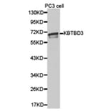 Anti-KBTBD3 Antibody from Bioworld Technology (BS6807) - Antibodies.com
