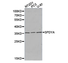 Anti-SPDYA Antibody from Bioworld Technology (BS6810) - Antibodies.com