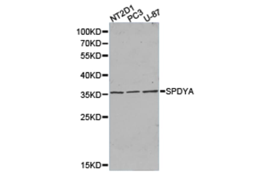 Anti-SPDYA Antibody from Bioworld Technology (BS6810) - Antibodies.com