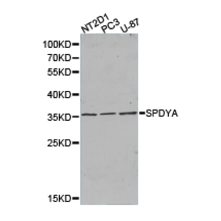 Anti-SPDYA Antibody from Bioworld Technology (BS6810) - Antibodies.com