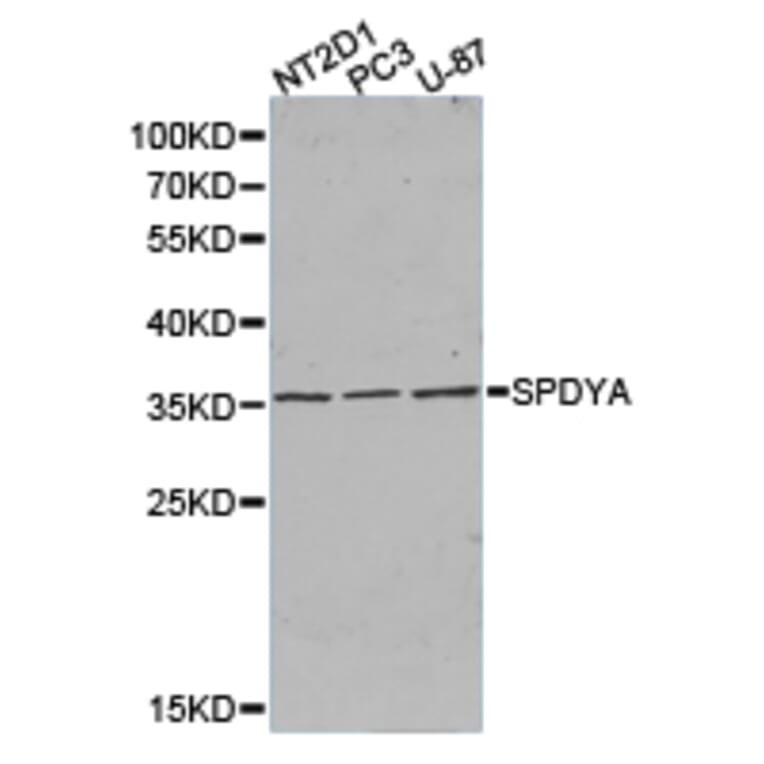 Anti-SPDYA Antibody from Bioworld Technology (BS6810) - Antibodies.com