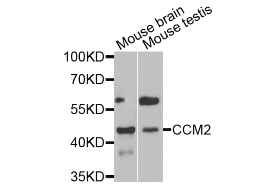 Anti-CCM2 Antibody from Bioworld Technology (BS6813) - Antibodies.com