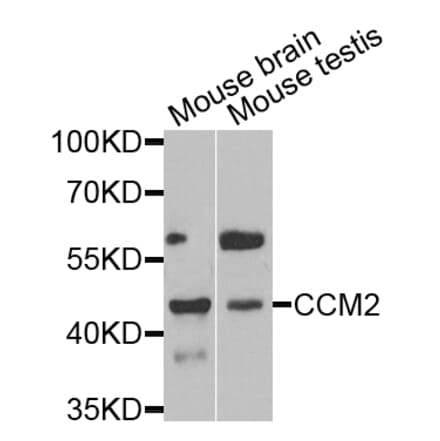 Anti-CCM2 Antibody from Bioworld Technology (BS6813) - Antibodies.com