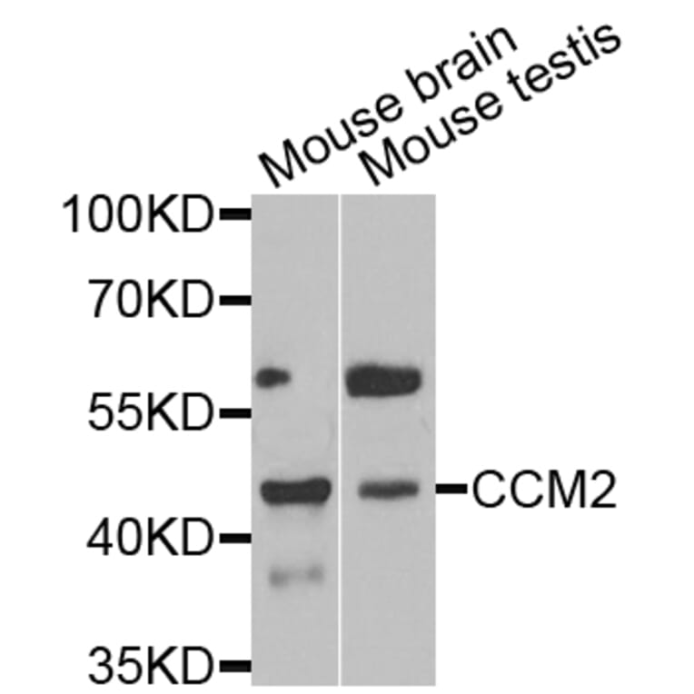 Anti-CCM2 Antibody from Bioworld Technology (BS6813) - Antibodies.com