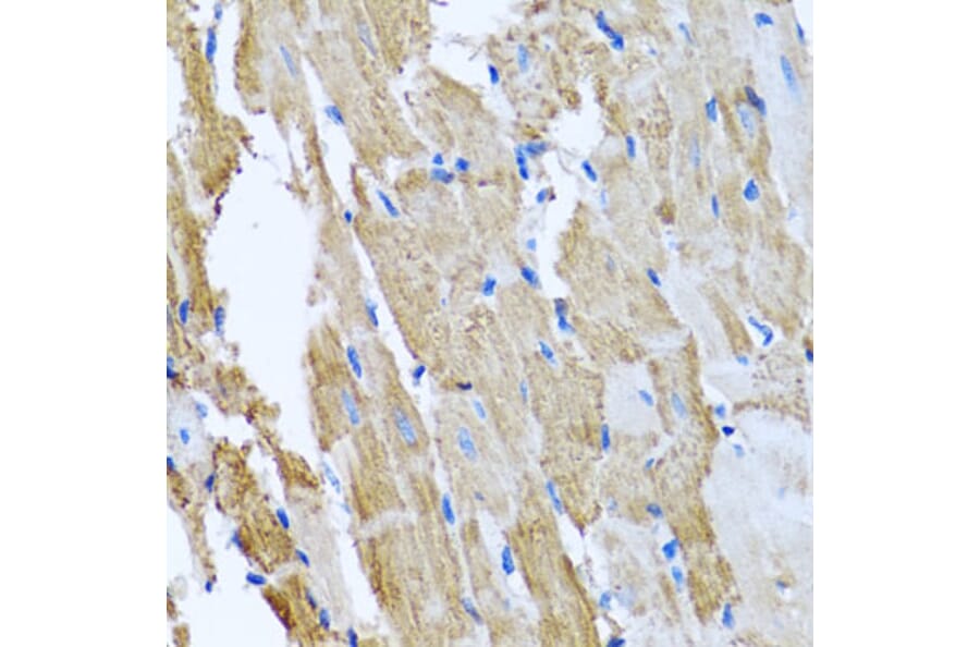 Anti-CCM2 Antibody from Bioworld Technology (BS6813) - Antibodies.com