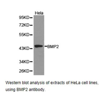 Anti-BMP2 Antibody from Bioworld Technology (BS6815) - Antibodies.com